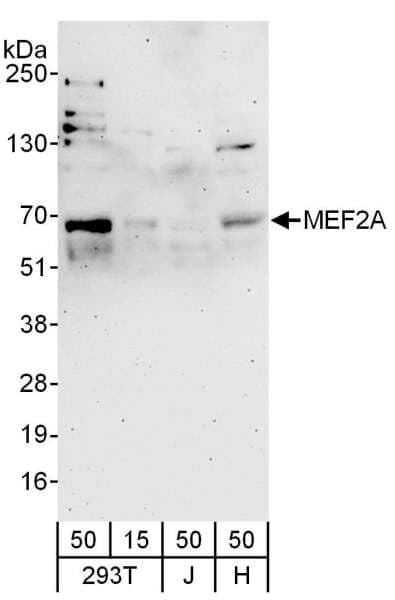 MEF2A / MEF2 Antibody (aa175-225)