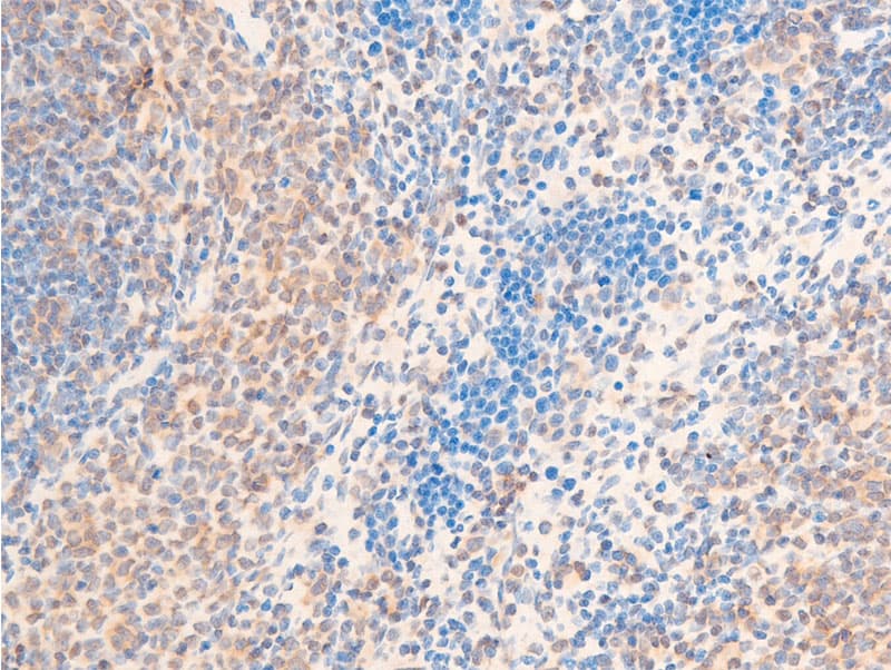 HSPB6 / HSP20 Antibody (phospho-Ser16)