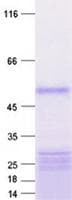 Human CEP57L1 Protein (Recombinant His, N-Terminal)