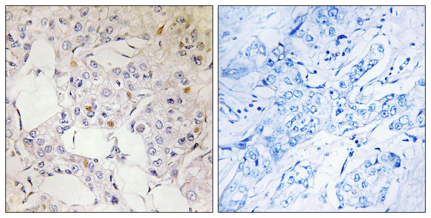 NCOA2 / TIF2 Antibody (Ab-736)
