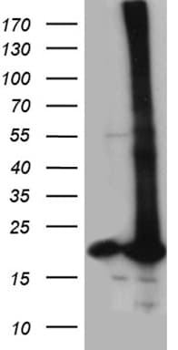 POLR2H / RPB8 Antibody (aa2-150, clone OTI4A12)