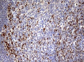 TOP2A / Topoisomerase II Alpha Antibody (aa1100-1531, clone OTI2A9)