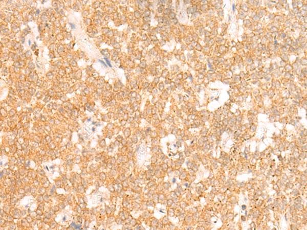 RRP8 Antibody