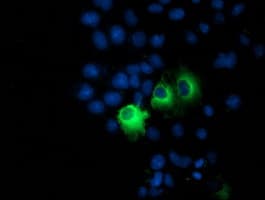 Monoclonal Mouse anti-Human PPM1B Antibody (clone OTI3C9, IF, WB)