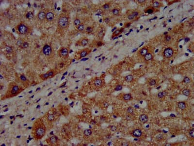 CYP8B1 Antibody