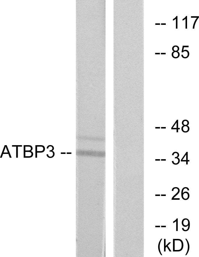 Polyclonal Rabbit anti-Human CTU1 Antibody (WB)