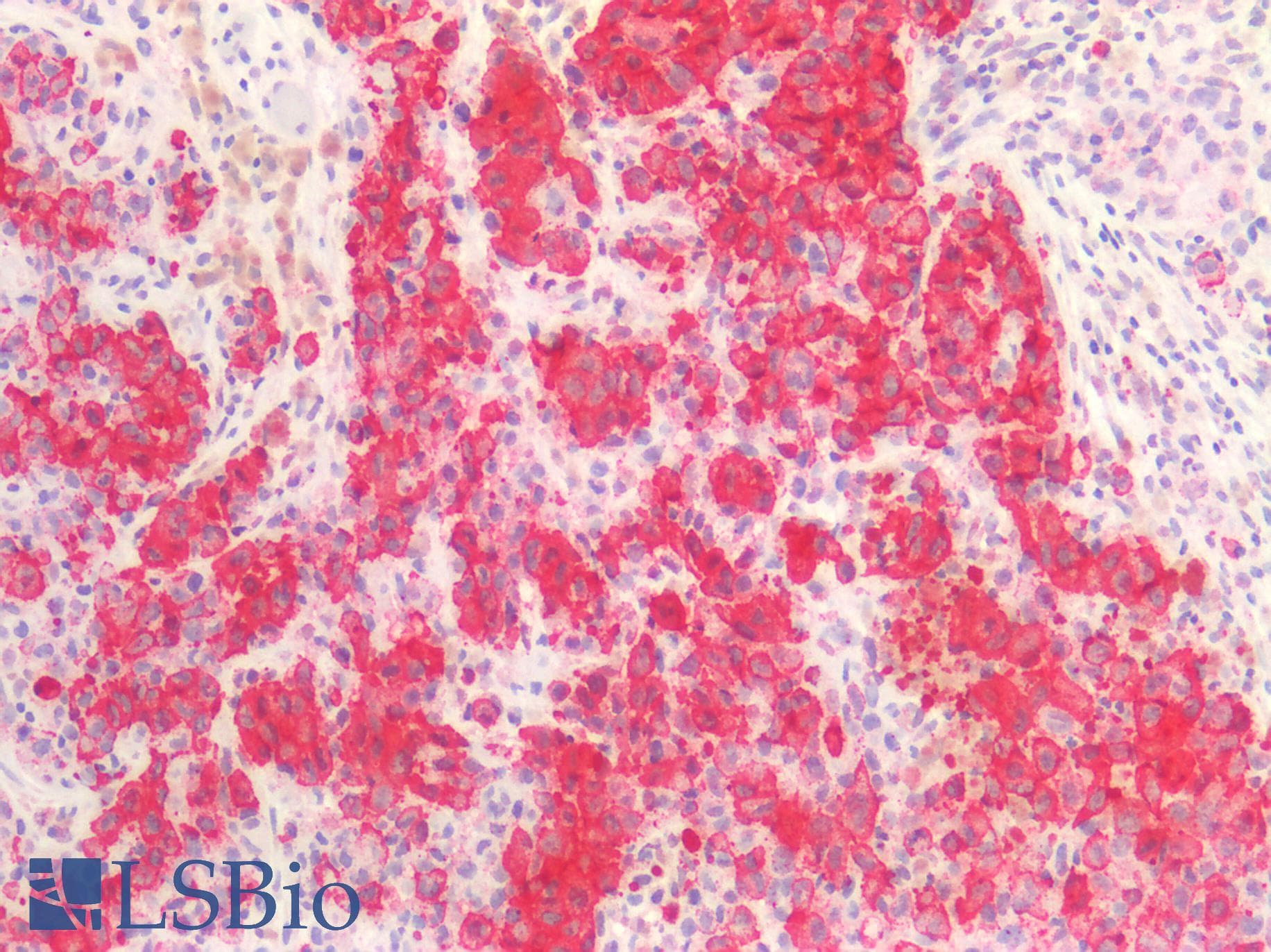 PathPlus™ HMB45 Antibody (Concentrated)
