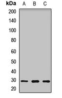 Polyclonal Rabbit anti-Human UCK2 Antibody (WB)