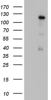 GLI / GLI1 Antibody (aa1-410, clone OTI2D5E2)
