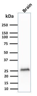 UCHL1 / PGP9.5 Antibody (clone rUCHL1/775, Azide-free, Carrier-free)
