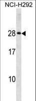 HLA-DQA2 Antibody (aa39-66)