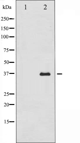 Polyclonal Rabbit anti-Human ANXA2 / Annexin A2 Antibody (IHC, WB)