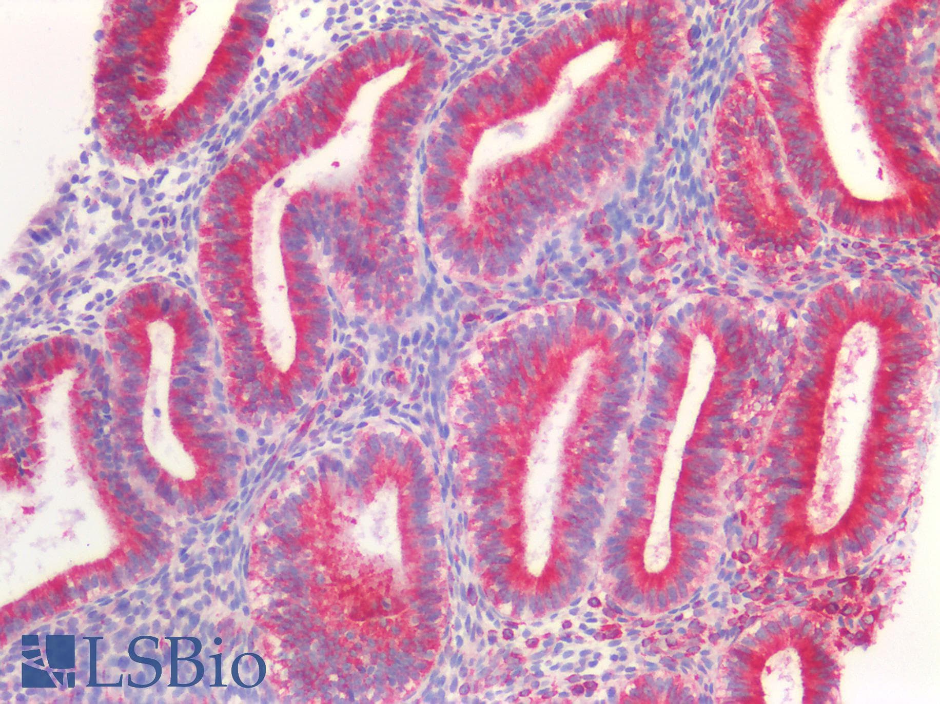 Polyclonal Rabbit anti-Human TUBB / Beta Tubulin Antibody (IHC, WB)