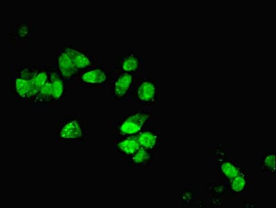 IHC-plus™ DYNLL1 / PIN Antibody (aa1-89)