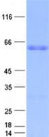 Human FLCN / Folliculin Protein (Recombinant GST, N-terminus + His, C-terminus)