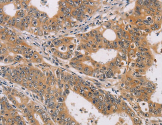 Polyclonal Rabbit anti-Human CDK11B / CDC2L1 Antibody (IHC, WB)