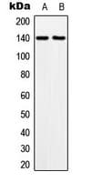 MOV10L1 Antibody (Internal)