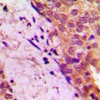 Polyclonal Rabbit anti-Human FE65L1 / APBB2 Antibody (Internal, IHC, WB)