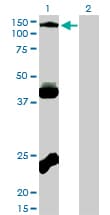 EPHB3 / EPH Receptor B3 Antibody (clone 1B3)