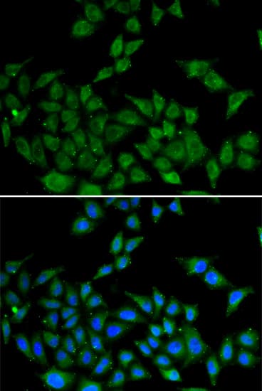 DATF1 / DIDO1 Antibody