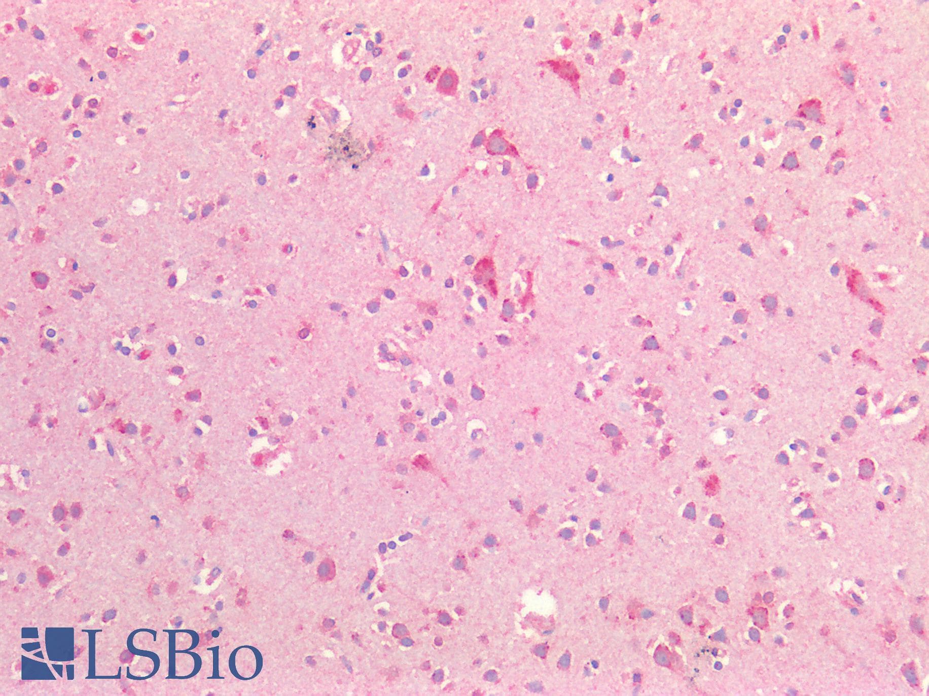 PathPlus™ Polyclonal Rabbit anti-Human 5-Alpha Reductase / SRD5A1 Antibody (IHC)