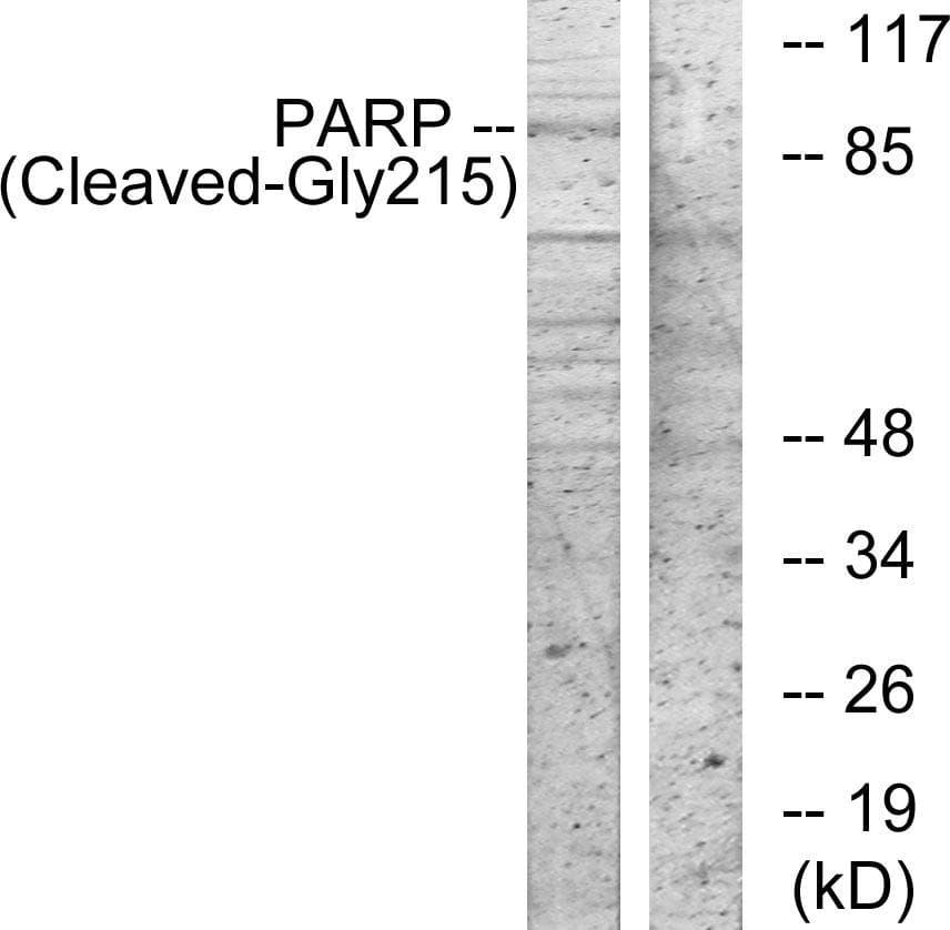 PARP1 Antibody (Cleaved-Gly215)