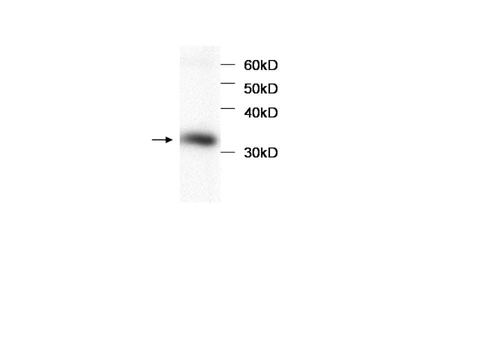 HBB / Hemoglobin Beta Antibody