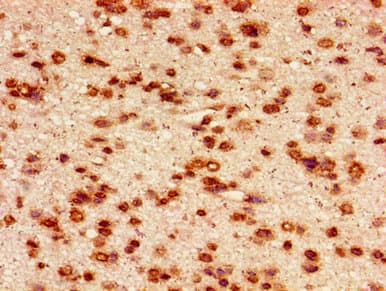 Polyclonal Rabbit anti-Human HIST1H2AI Antibody (IHC, IF)