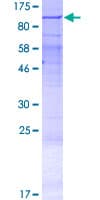 Human LRRC49 Protein (Recombinant GST)