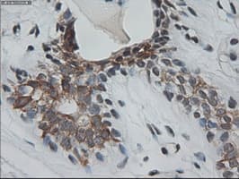 KRT18 / CK18 / Cytokeratin 18 Antibody (clone OTI1E1)