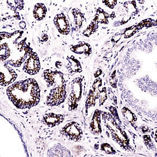 Polyclonal Rabbit anti-Human AMACR / P504S Antibody (IHC)