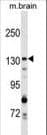 GAK Antibody (aa1140-1170)