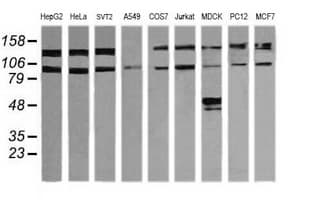 PIK3R5 Antibody (clone OTI2A6)