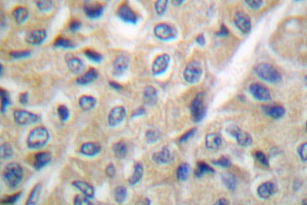 Polyclonal Rabbit anti-Human FHIT Antibody (Glu116, IHC, IF, WB)