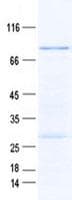 Human NSUN5 Protein (Recombinant GST, N-terminus + His, C-terminus)