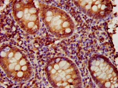 Polyclonal Rabbit anti-Human EAF2 / U19 Antibody (IHC, IF, WB)