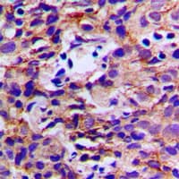 DDX3Y Antibody (N-Terminus)