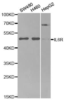 Polyclonal Rabbit anti-Human IL6R / IL6 Receptor Antibody (aa20-320, IHC, WB)