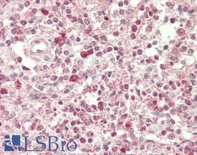 Polyclonal Rabbit anti-Human SLAMF1 / SLAM / CD150 Antibody (aa264-313, IHC, WB)