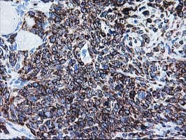 ALDH3A2 Antibody (clone OTI2A7)