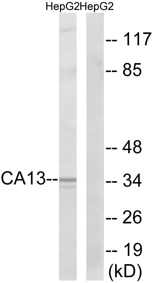 Polyclonal Rabbit anti-Human CA13 / Carbonic Anhydrase XIII Antibody (aa141-190, WB)
