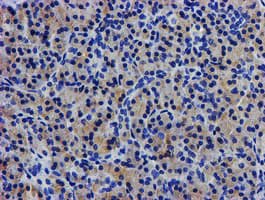 Monoclonal Mouse anti-Human LPL / Lipoprotein Lipase Antibody (clone OTI4G7, IHC, IF, WB)