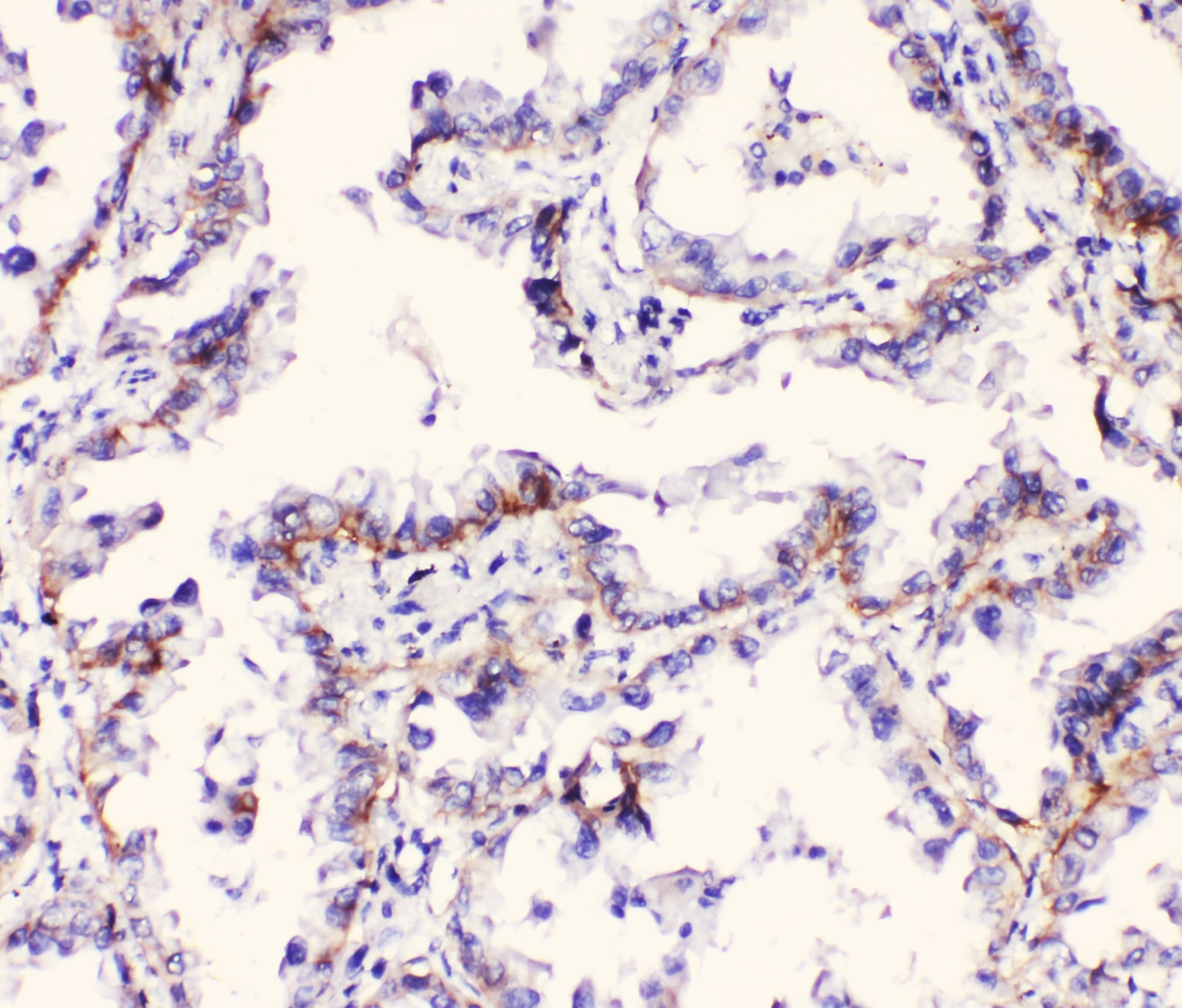 Polyclonal Rabbit anti-Human ITGA3 / CD49c Antibody (IHC, WB)