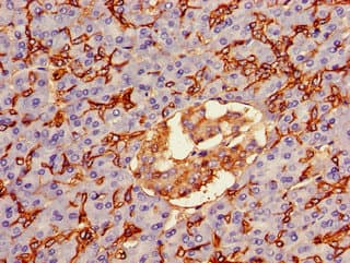 AQP1 / Aquaporin 1 Antibody