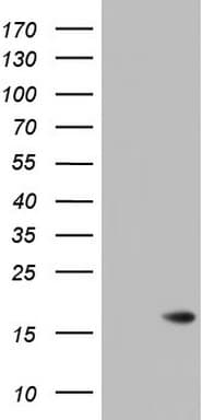 Monoclonal Mouse anti-Human ISCU Antibody (clone OTI8H2, WB)