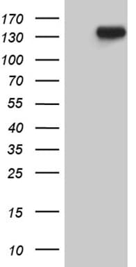 Monoclonal Mouse anti-Human USP40 Antibody (clone OTI2E5, aa767-912, WB)