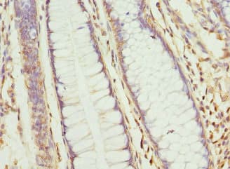 CLC-7 / CLCN7 Antibody