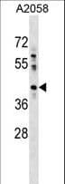HACD3 / PTPLAD1 Antibody (aa32-58)