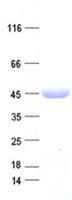 Human UPB1 Protein (Recombinant His, N-Terminal)