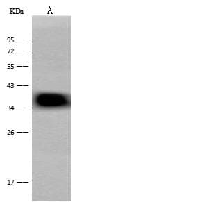 Polyclonal Rabbit anti-Mouse CRELD2 Antibody (Preservative Free, IHC, WB)